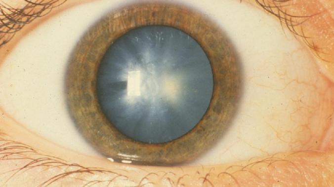 eye image from motherboard vice artificial intelligence